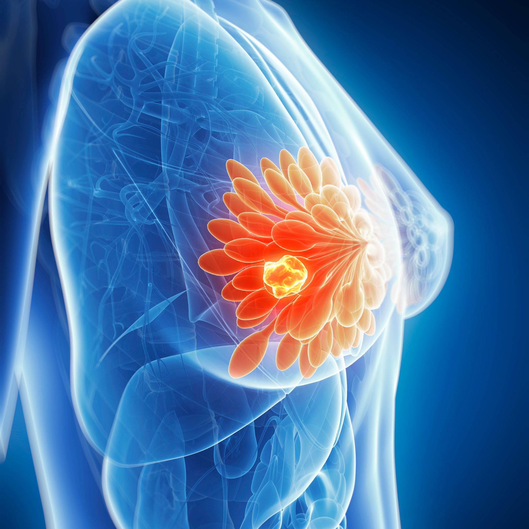 BREAST